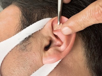 男性の耳つぼ施術風景